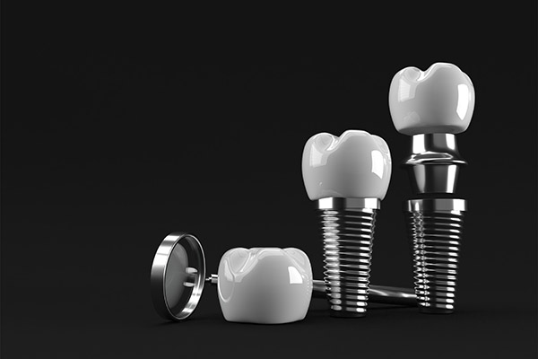 An Implant Dentist Explains the Parts Used in the Procedure from Modern Smiles Family Dentistry in Phoenix, AZ