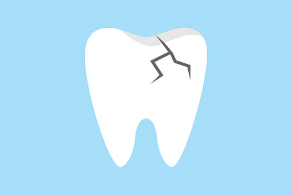 Ask an Implant Dentist About Replacing a Damaged Tooth from Modern Smiles Family Dentistry in Phoenix, AZ