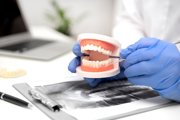 How Long Dentures May Last