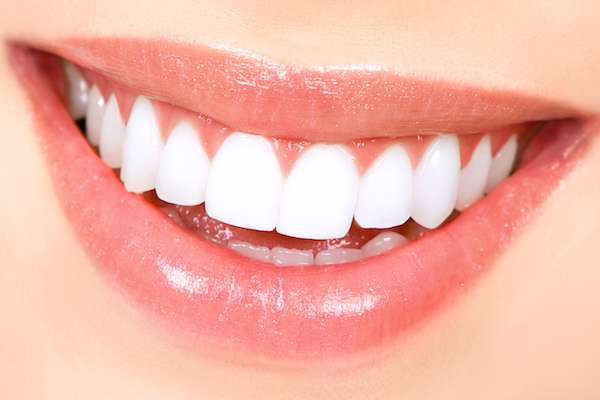 How Long Does Teeth Whitening Take from Modern Smiles Family Dentistry in Phoenix, AZ