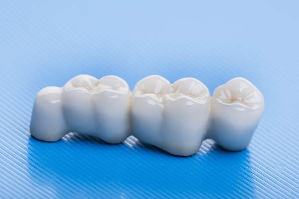 How Many Teeth Can Dental Bridges Replace from Modern Smiles Family Dentistry in Phoenix, AZ