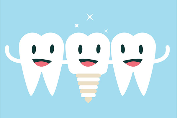 Implant Dentistry Aftercare FAQs from Modern Smiles Family Dentistry in Phoenix, AZ