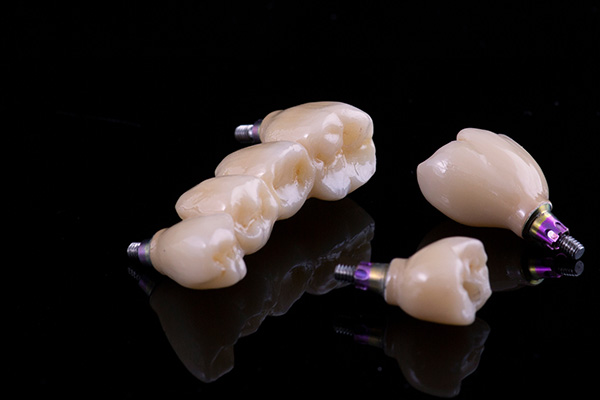 Implant Dentistry Options for Multiple Missing Teeth from Modern Smiles Family Dentistry in Phoenix, AZ