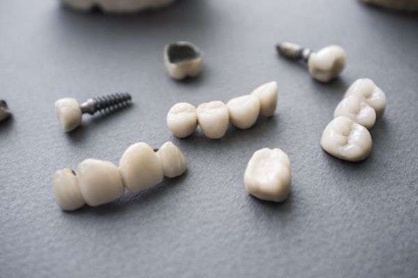 Types of Dental Implants from Modern Smiles Family Dentistry in Phoenix, AZ
