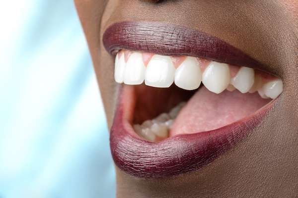 Routine Dental Care: What Are Tooth Colored Fillings from Modern Smiles Family Dentistry in Phoenix, AZ